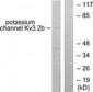 KCNC2 / Kv3.2 Antibody (aa589-638)