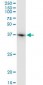 ACTB / Beta Actin Antibody (clone 1E7)