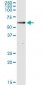 ALDH1A1 / ALDH1 Antibody (clone 1G6)