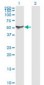 ALDH1A1 / ALDH1 Antibody (clone 1G6)