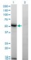 ASAH1 / Acid Ceramidase Antibody (clone 1A7)