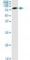 SERPING1 / C1 Inhibitor Antibody (clone 3F4-1D9)