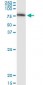 SERPING1 / C1 Inhibitor Antibody (clone 3F4-1D9)