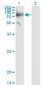 SERPING1 / C1 Inhibitor Antibody (clone 3F4-1D9)