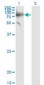 SERPING1 / C1 Inhibitor Antibody (clone 3F4-1D9)