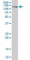 CDH17 / Cadherin 17 Antibody (clone 1H3)