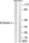 CD75 / ST6GAL1 Antibody (aa171-220)