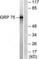 HSPA9 / Mortalin / GRP75 Antibody (aa630-679)
