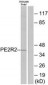 PTGER2 / EP2 Antibody (aa261-310)