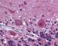PDGFRA / PDGFR Alpha Antibody (aa1035-1053)