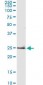 TNF Alpha Antibody (clone M 1 C4)