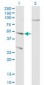 CTSD / Cathepsin D Antibody (clone 3F12-1B9)