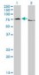 EWSR1 / EWS Antibody (clone 5C10)