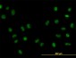 FOXA1 Antibody (clone 3C1)