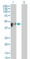 KRT17 / CK17 / Cytokeratin 17 Antibody (clone 2D10)