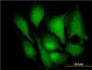 MAPK3 / ERK1 Antibody (clone 3C9)