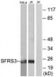 SRSF3 / SRP20 Antibody (aa111-160)