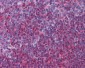 ERK1 + ERK2 Antibody