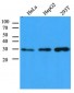 CBR / CBR1 Antibody (clone AT4E12)