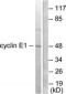 CCNE1 / Cyclin E1 Antibody (aa91-140)