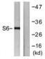 RPS6 / S6 Antibody (aa191-240)
