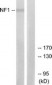 Neurofibromin / NF1 Antibody (aa1551-1600)