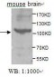 TNK2 / ACK1 Antibody (aa278-289)