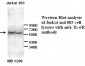 IL6R / IL6 Receptor Antibody