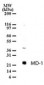 MD-1 / LY86 Antibody (aa112-125)