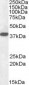 EPM2A / Laforin Antibody (Internal)