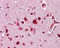 MAPK14 / p38 Antibody