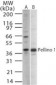 PELI1 / Pellino 1 Antibody (aa121-135)