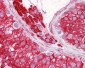 RTN4 / Nogo Antibody (aa14-30)