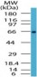 RELA / NFKB p65 Antibody