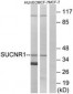 SUCNR1 / GPR91 Antibody (aa100-149)