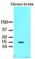 FABP7 / BLBP / MRG Antibody (aa1-132, clone AT1D1)