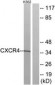 CXCR4 Antibody (aa300-349)