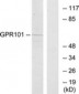 GPCR6 / GPR101 Antibody (aa451-500)