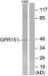 GPR151 Antibody (aa370-419)