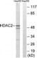 HDAC2 Antibody (aa360-409)