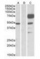 ANGPT1 / Angiopoietin-1 Antibody (Internal)