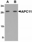 ANAPC11 / APC11 Antibody (Internal)