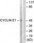 CCNE1 / Cyclin E1 Antibody (aa361-410)