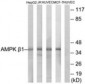 PRKAB1 / AMPK Beta 1 Antibody (aa147-196)