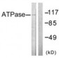 ATP1A1 Antibody (aa5-54)