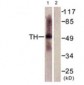 TPH1 / TPH Antibody (aa26-75)