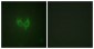 MARK2 Antibody (aa562-611)