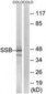 SSB / La Antibody (aa341-390)