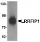 TRIP / LRRFIP1 Antibody (C-Terminus)