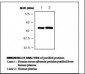 ALB / Serum Albumin Antibody (clone 1G2)